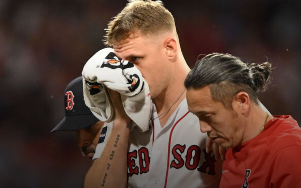 Red Sox pitcher Houck exits after taking comebacker off face